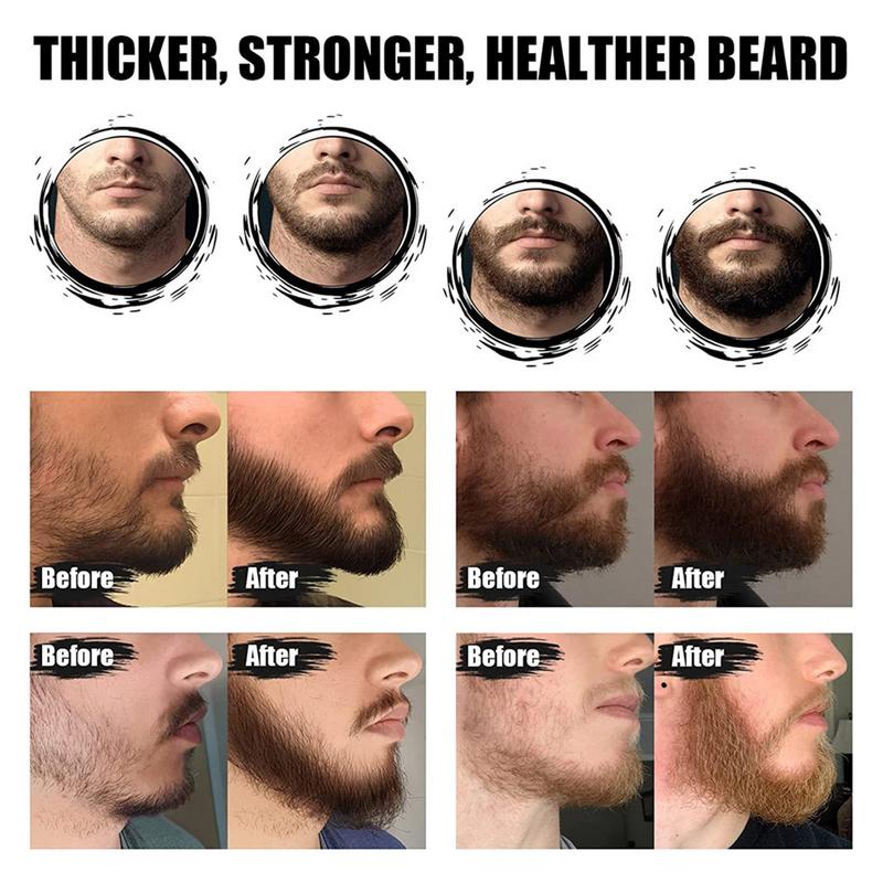 5pcs Men Beard Barba Grooming  - Men'S Grooming Tonic review and price
